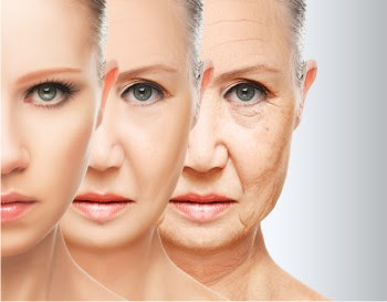 Aging1