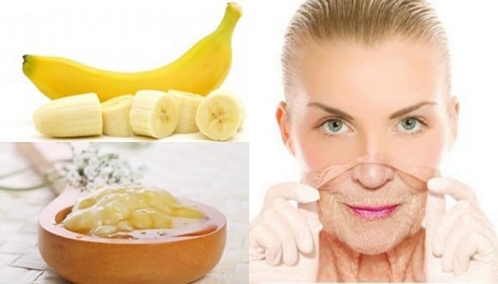 Ποιος Χρειάζεται Botox Όταν Έχει Μπανάνες;
