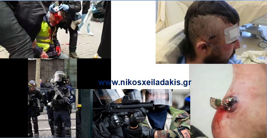 ΠΩΣ ΜΙΑ ΑΛΛΗ ΑΣΤΥΝΟΜΙΑ ΘΑ ΤΡΟΜΟΚΡΑΤΕΙ ΤΟΥΣ ΛΑΟΥΣ(Βίντεο)