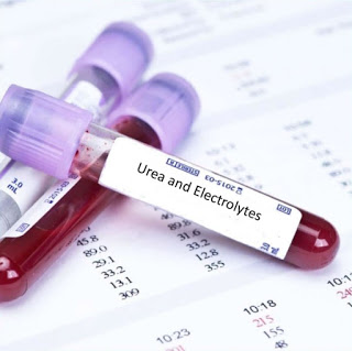 urea-and-electrolytes-private-blood-tests-in-london