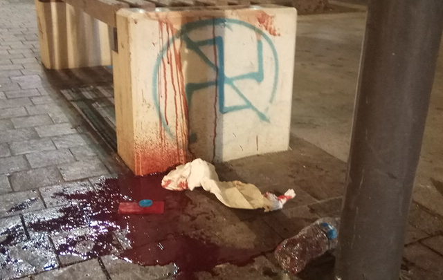 ΕΞΟΡΓΙΣΤΙΚΗ ΚΟΜΜΟΥΝΙΣΤΙΚΗ ΠΡΟΒΟΚΑΤΣΙΑ! ΜΕ ΦΩΤΟΓΡΑΦΙΑ ΑΠΟ ΤΟ ΑΙΜΑ ΘΥΜΑΤΟΣ ΤΟΥΣ, ΟΙ «ΑΝΤΙΦΑΣΙΣΤΕΣ» ΚΑΤΑΓΓΕΛΛΟΥΝ «ΦΑΣΙΣΤΙΚΗ ΕΠΙΘΕΣΗ»!