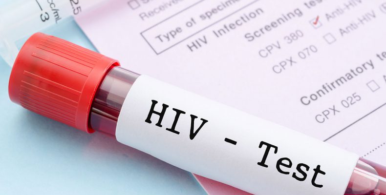 AIDS: Γενετική μετάλλαξη δημιουργεί «φυσική ανοσία» στον ιό HIV