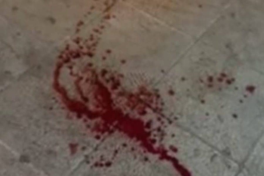 Μαχαιρώθηκε Έλληνας στη Μυτιλήνη από αλλοδαπούς αιτούντες ασύλου