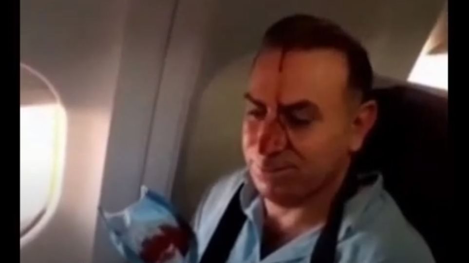 Τρόμος στον αέρα για επιβάτες ιρανικού αεροπλάνου: Τραυματίες από «παρενόχληση» αμερικανικού F-15 (βίντεο)