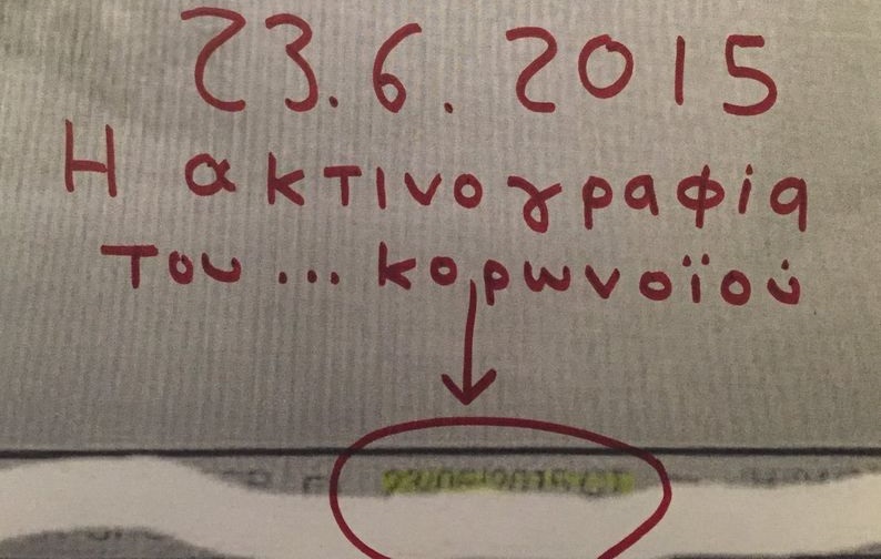 Νίκος Αντωνιάδης : Ψ Ε Υ Τ Ε Σ !!! ΑΠΙΣΤΕΥΤΗ Α Π Α Τ Η ΜΕ ΑΚΤΙΝΟΓΡΑΦΙΕΣ ΠΟΥ “ΔΕΙΧΝΟΥΝ ΤΗΝ ΕΠΙΔΕΙΝΩΣΗ 38ΧΡΟΝΟΥ ΑΠΟ ΤΟΝ ΚΟΡΩΝΟΪΟ” :  ΕΙΝΑΙ ΑΚΤΙΝΟΓΡΑΦΙΕΣ ΤΟΥ 2 0 1 5 !!!