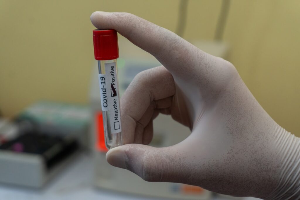 Επίδομα κορωνοϊού : Είδηση «βόμβα» από την Βρετανία – BINTEO