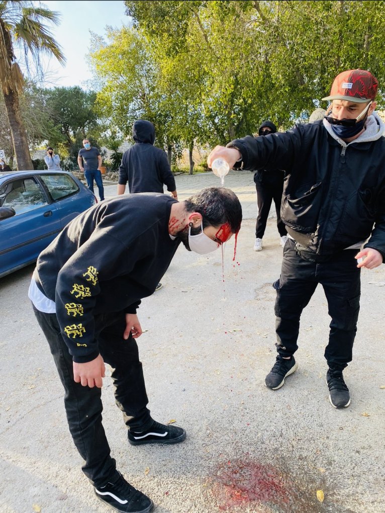 ΜΑΤΩΣΑΝ ΤΗΝ ΚΥΠΡΟ! Χτύπησαν πορεία κατά της υγειονομικής χούντας στη Λευκωσία..Άνοιξαν κεφάλια, Χτύπησαν γυναικόπαιδα!!ΒΙΝΤΕΟ