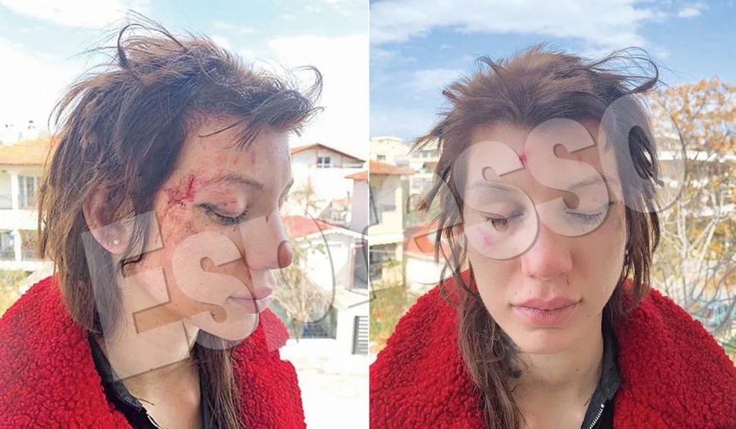 Ο αναμάρτητος πρώτος τον λίθον βαλέτω..