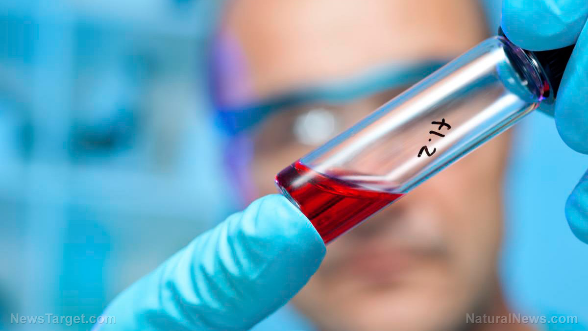 Natural News : Ο Ερυθρός Σταυρός προειδοποιεί να σταματήσουν οι δωρεές πλάσματος αίματος από εμβολιασμένους ανθρώπους