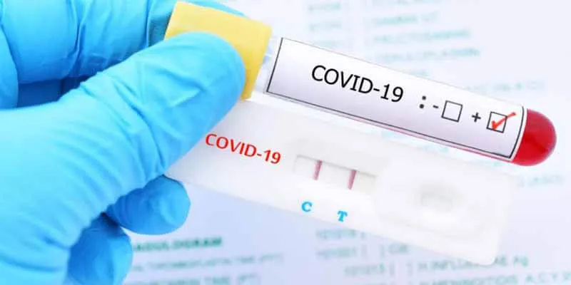 ΣΟΚ ΜΕ RAPID ΚΑΙ PCR ΤΕΣΤ ΣΕ ΚΥΠΡΟ ΚΑΙ ΕΛΛΑΔΑ – ΙΔΙΟΣ ΟΜΙΛΟΣ, ΔΙΠΛΑΣΙΕΣ ΤΙΜΕΣ! Ντοκουμέντα που προκαλούν