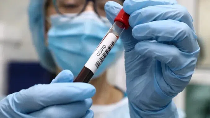 Νέα έκθεση του Lancet υποδηλώνει ότι το COVID προήλθε από αμερικανικό εργαστήριο