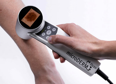 microDERM_anwendung_1_w_Display_m