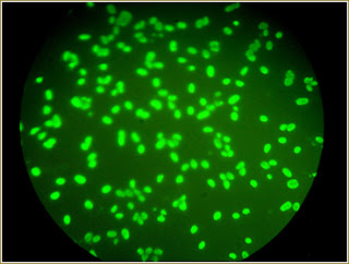 ureaplasma