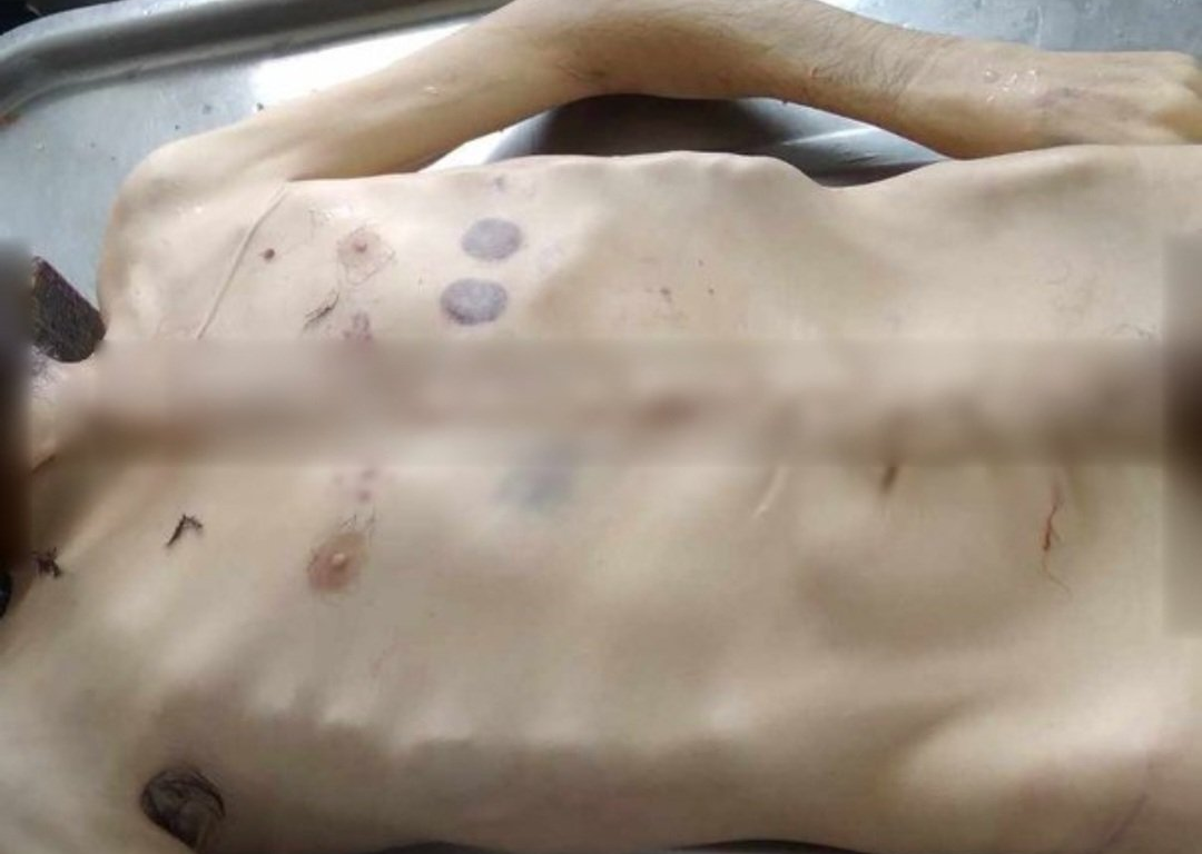 40χρονος πέθανε από υποσιτισμό λόγω του αποκλεισμού του Αρτσάχ από το Αζερμπαϊτζάν! 300.000 χριστιανοί κινδυνεύουν από γενοκτονία! ΦΩΤΟ