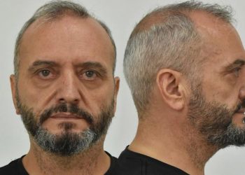 Κορυφαία καθηγήτρια ΕΚΠΑ για βιασμό 12χρονης στο Κολωνό: Ο Μίχος είναι ήρωας γιατί καλύπτει επώνυμους στο κύκλωμα!