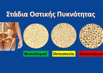 D3 & K2 ΠΡΟΛΗΨΗ ΓΙΑ ΟΣΤΕΟΠΕΝΙΑ & ΟΣΤΕΟΠΟΡΩΣΗ
