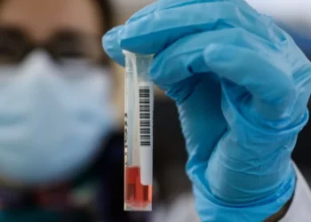 Mpox: Ο Παγκόσμιος Οργανισμός Υγείας… συστήνει (!) την έναρξη προγραμμάτων εμβολιασμού στις πληγείσες περιοχές