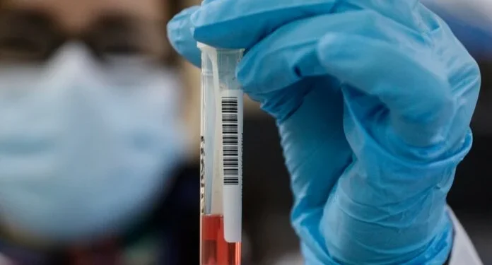 Mpox: Ο Παγκόσμιος Οργανισμός Υγείας… συστήνει (!) την έναρξη προγραμμάτων εμβολιασμού στις πληγείσες περιοχές