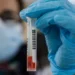 Mpox: Ο Παγκόσμιος Οργανισμός Υγείας… συστήνει (!) την έναρξη προγραμμάτων εμβολιασμού στις πληγείσες περιοχές