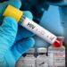 ΒΟΜΒΑ: Μόλυνση από τον ιό HIV/AIDS Βρέθηκε στο εμβόλιο Covid της Moderna