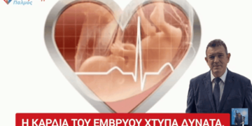 Νίκος Παπαδόπουλος: «Η καρδιά του εμβρύου χτυπά. Χτυπά ΔΥΝΑΤΑ.. »