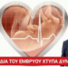 Νίκος Παπαδόπουλος: «Η καρδιά του εμβρύου χτυπά. Χτυπά ΔΥΝΑΤΑ.. »
