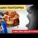 Νικόλαος Παπαδόπουλος: Παιδική παχυσαρκία: το σύμπτωμα μιας κοινωνίας που εξαντλεί τις οικογένειες…