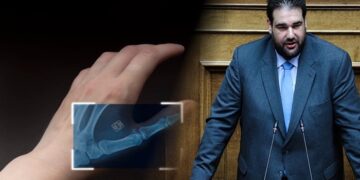 Λιβάνιος: «Ετοιμάζουμε ηλεκτρονική ψήφο για τις αυτοδιοικητικές εκλογές του 2028 – Πρώτο βήμα με ψηφιακά εκλογικά τμήματα»