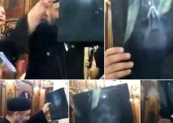 Αίγυπτος.. Θαυματουργή θεραπεία και εμφάνιση της Παναγίας σε υπερηχογράφημα όγκου στον εγκέφαλο!