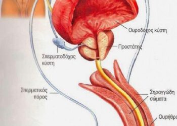 Φυσική αντιμετώπιση των λοιμώξεων ουροποιητικού και γεννητικού συστήματος των ανδρών