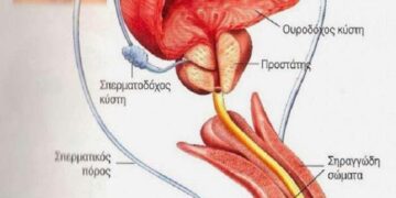 Φυσική αντιμετώπιση των λοιμώξεων ουροποιητικού και γεννητικού συστήματος των ανδρών
