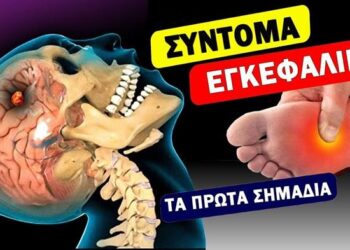 Πριν Συμβεί Το Εγκεφαλικό, Το Σώμα Θα Στείλει 5 Σημάδια! ΜΗΝ ΤΑ ΑΓΝΟΗΣΕΤΕ | Ακαδημία Υγείας